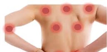 Imagen noticia |exvobromialgia...
