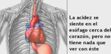 Imagen noticia ugytoz de estómago 