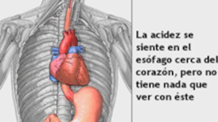 Qu es la Acidez Qu es la Acidez