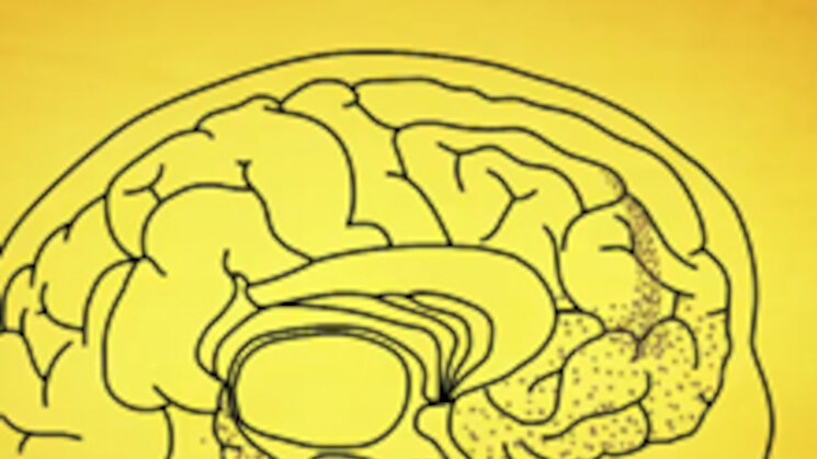 What is Alzheimers Disease Spanish What is Alzheimers Disease Spanish