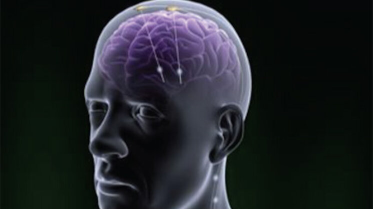 I Jornadas sobre estimulacin cerebral I Jornadas sobre estimulacin cerebral