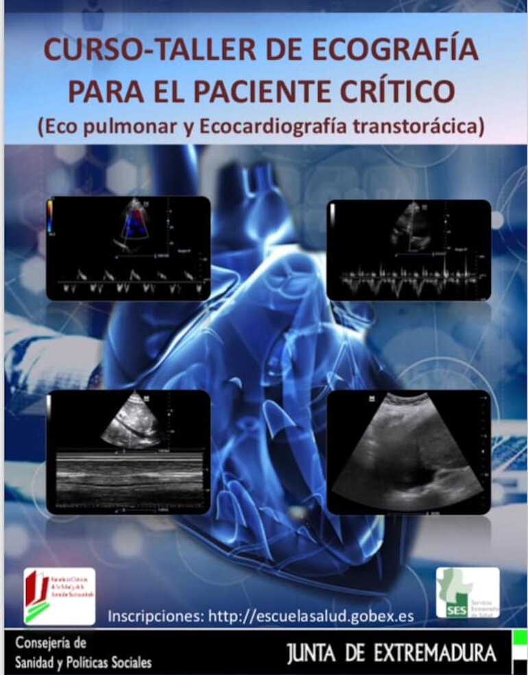 3 Edicin del CursoTaller de Ecografa para el paciente crtico ETT y Ecopulmonar 3 Edicin del CursoTaller de Ecografa para el paciente crtico ETT y Ecopulmonar